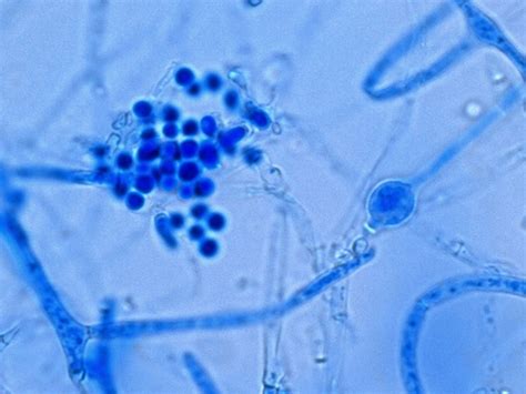 Fun With Microbiology (What's Buggin' You?): Trichophyton ...