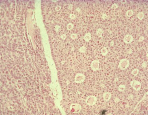 Cytopathology Final Flashcards Quizlet