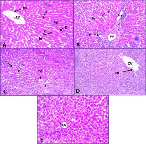 Photomicrograph Of Liver Sections Stained With Haematoxylin And Eosin Download Scientific