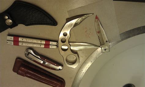 Small subdermal cysts : r/popping