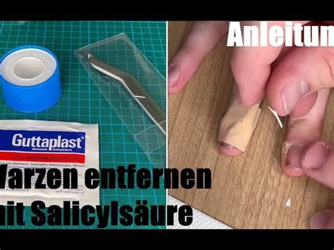 Guttaplast Anwendung Tipps und Tricks für eine effektive Nutzung