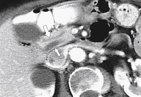 Pancreas | Clinical Gate