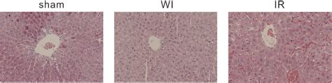 Representative Hematoxylin And Eosin Staining Examination Of Liver