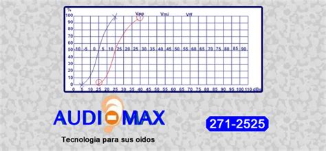 Audiomax Logoaudiometria Audiomax