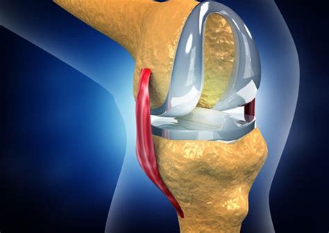 Best Knee Replacement Hospital In Ahmedabad Sterling Hospitals By Sterling Hospitals May