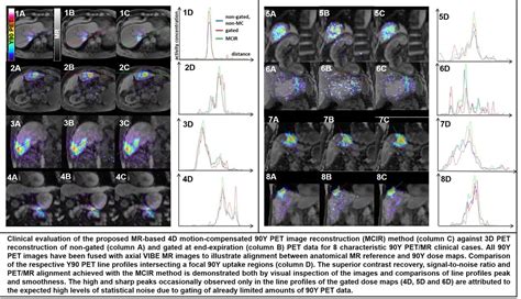 Motion Compensated 90y Petmr Image Reconstruction For Enhanced