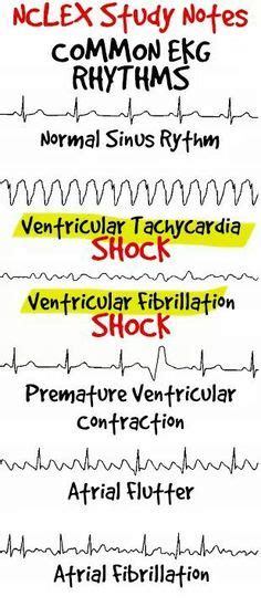 Shockable And Non Shockable Rhythms Nursing School Tips Emergency