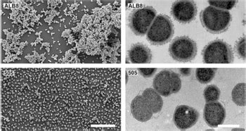 Finegoldia magna - microbewiki