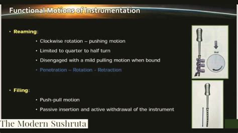 Functional Motions Of Instrumentation In Endodontics Filing Reaming