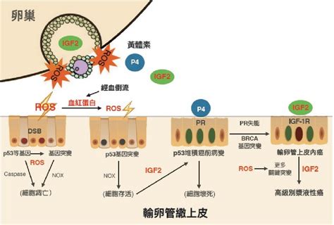 卵巢癌 婦女隱形的殺手發生原因與預防之道 台灣癌症基金會