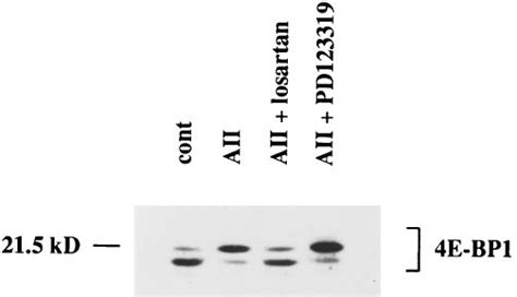 Effect Of Aii Receptor Antagonists On Aii Stimulation Of E Bp