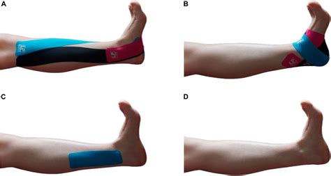 Frontiers Acute Effect Of Kinesio Tape On Postural Control In