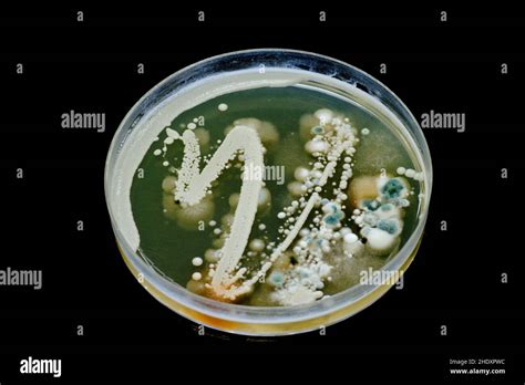 Mold And Bacteria Growing On A Agar Petri Dish Stock Photo Alamy