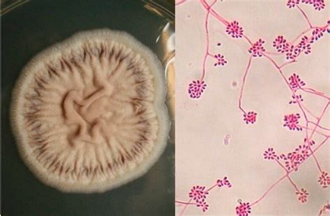 Sporothrix schenckii- An Overview