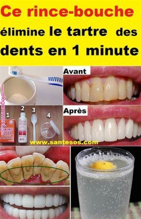 Ce Rince Bouche Limine Le Tartre Des Dents En Minute Rince Bouche