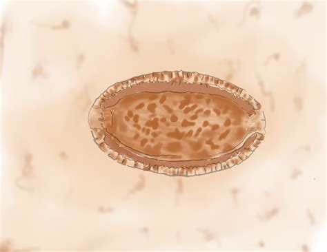 capillaria philippinensis capillaria hepatica parasitology world