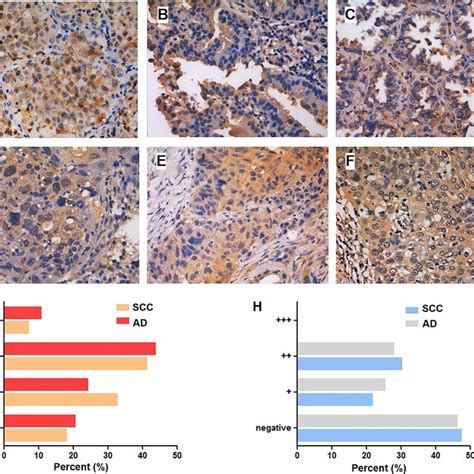 G Inhibited Gper Mediated Proliferation Stimulated By E And G In