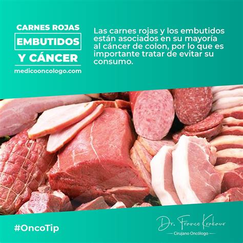 Carnes Rojas Embutidos Y Cáncer Dr Franco Krakaur Cirujano Oncólogo