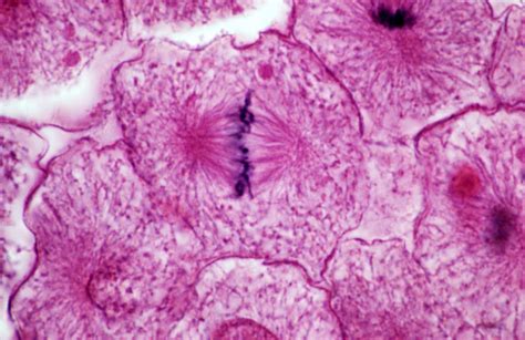 Cell In Middle Metaphase Stage Photograph By Michael Abbey Pixels