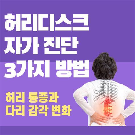 허리디스크 자가 진단 3가지 방법 허리 통증과 다리 감각 변화 루리메이드 블로그