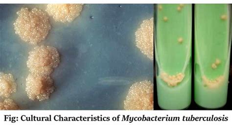 Mycobacterium tuberculosis- An Overview - Microbe Notes