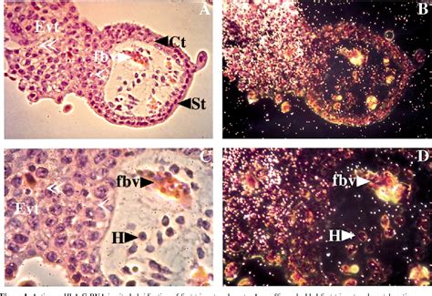 Figure From Lack Of Human Leukocyte Antigen G Expression In