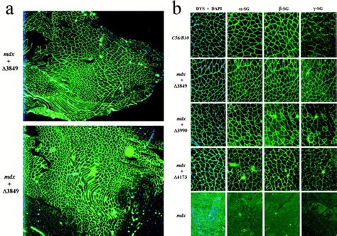 Adeno Associated Virus Vector Carrying Human Minidystrophin Genes