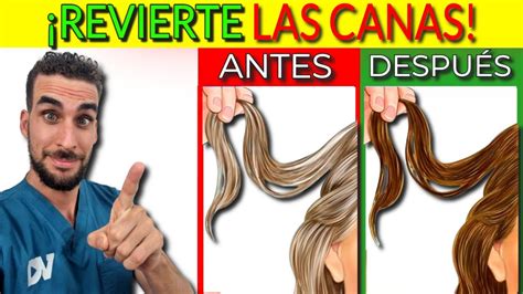 7 Remedios Caseros Efectivos Para Prevenir Y Revertir Las Canas De