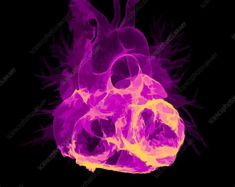 Healthy Heart Ct Scan Stock Image C057 3574 Science Photo Library