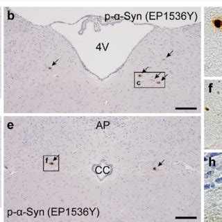 Inoculation Of Synuclein Syn Preformed Fibrils Pffs Into The