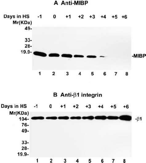 Downregulation Of MIBP Expression During Myogenesis A Mouse C2C12