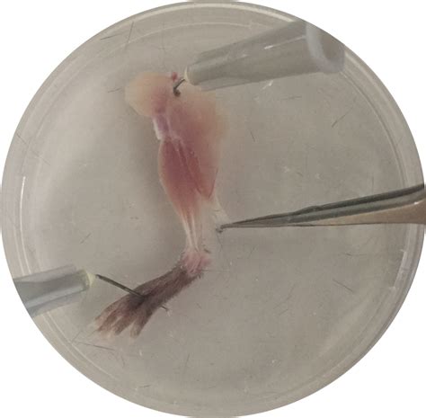 Dissection Of Mouse EDL And Soleus Muscles