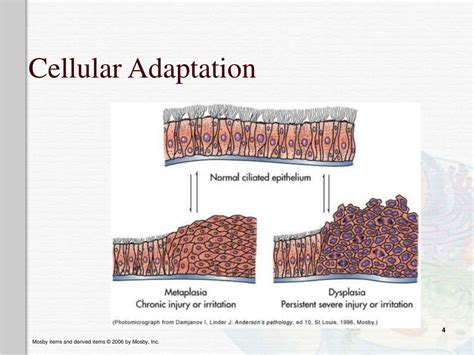 Ppt Altered Cellular And Tissue Biology Powerpoint Presentation Free