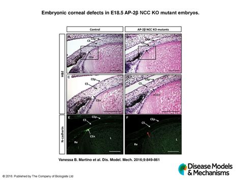 Embryonic Corneal Defects In E185 Ap 2β Ncc Ko Mutant Embryos Ppt