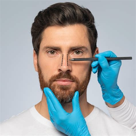 Concepto De Rinoplastia Guapo Hombre De Mediana Edad Con Marca En La