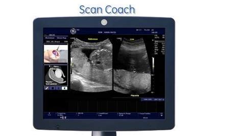 Logiq P Portable Ultrasound Refurbished Medpick