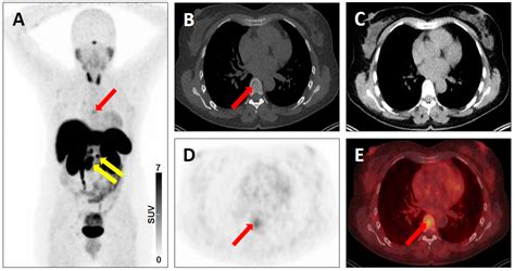 Jcm Free Full Text Recent Updates On Molecular Imaging Reporting