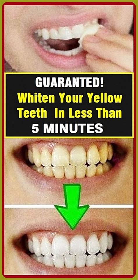 Guaranteed Whiten Your Yellow Teeth In Less Than 2 Minutes Healhty And Tips