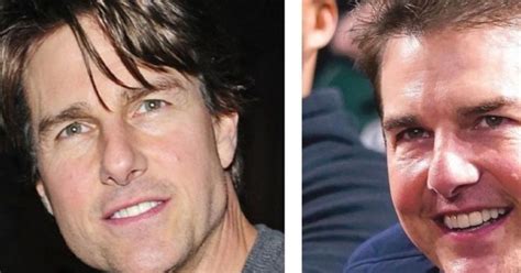 Otra V Ctima Del Botox Tom Cruise Aparece Con Nuevo Rostro Y Causa