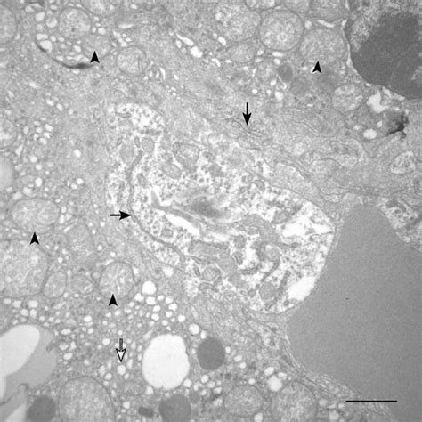 Transmission Electron Micrograph Of Adrenal Gland In An Adult Paca Download Scientific Diagram