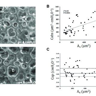 (A) Trans-pleural images of alveoli of different cross-sectional area ...