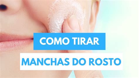 Como Tirar Manchas Do Rosto Melasma Manchas Na Pele Creme Caseiro