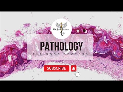 Hemodynamics Lecture 15 YouTube