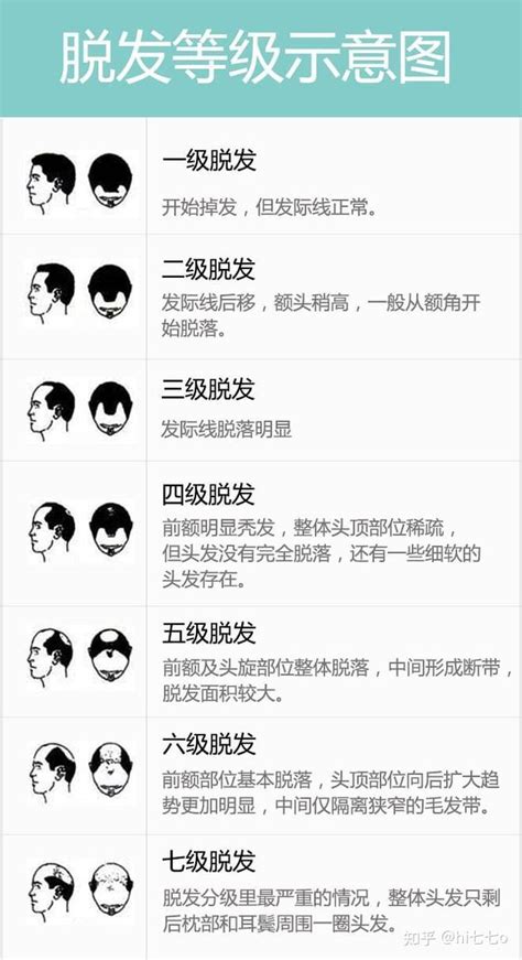 拯救发际线，这些你必须知道 知乎