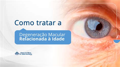 Como Tratar A Degenera O Macular Relacionada Idade