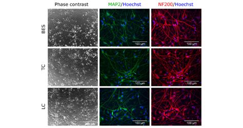 Neuronal Differentiation Of HNSCs After Bio Electrospray Assessed By