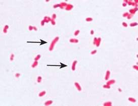 Vibrio And Shigella Flashcards Quizlet