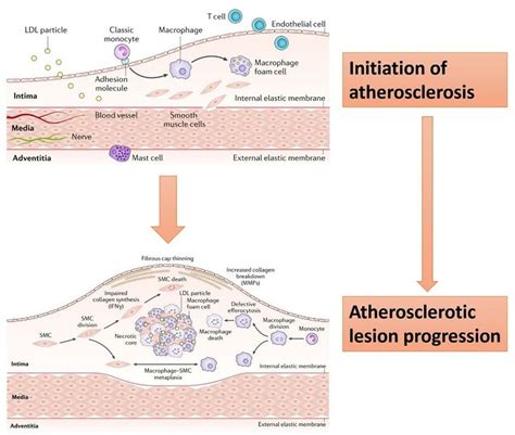 1 Schematic Summary Of The Initiation And Progression Processes In