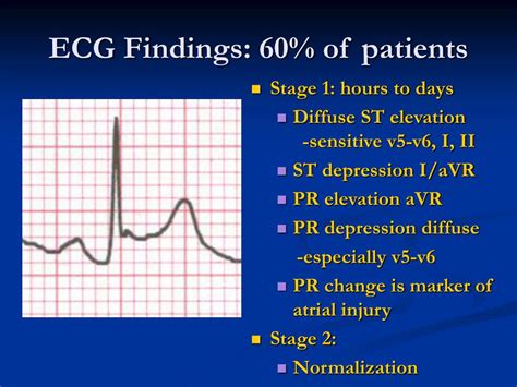 PPT Acute Pericarditis And Pericardial Effusion PowerPoint