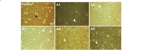 Treatment Of Skov 3 Cells With Ascites From Eoc Patients Cultures Of